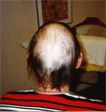 hair 1
